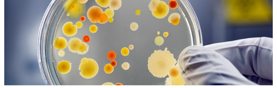Baktérie pre náročné použitie a špeciálne projekty